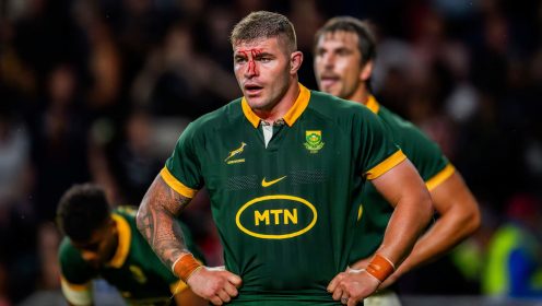 Springboks: Malcolm Marx receives surprise prognosis after leg break from ugly incident