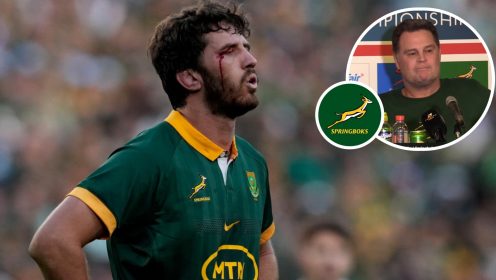Rassie Erasmus addresses the Springboks lineout issues and where it went wrong against the All Blacks