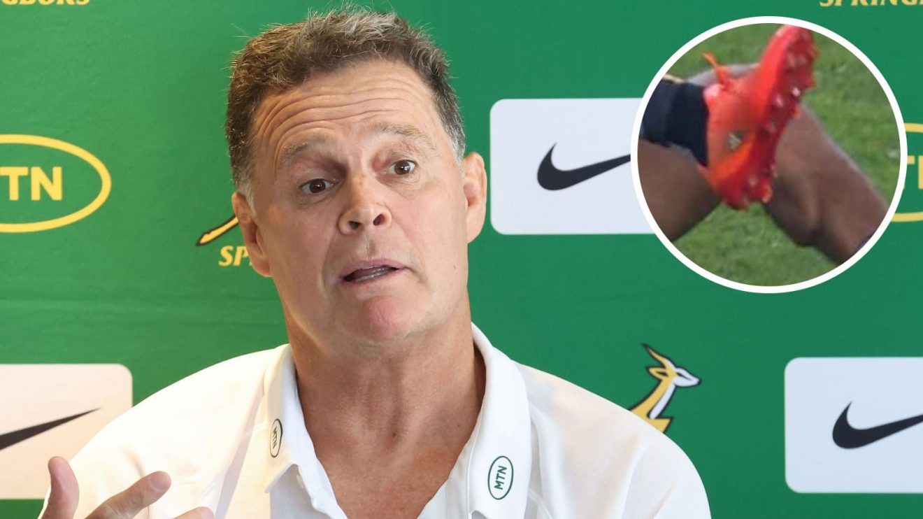 Springboks head coach Rassie Erasmus and picture of Jaden Hendrikse's leg (inset) after going down with cramp.